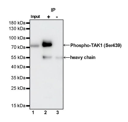 Phospho-TAK1 (Ser439) Recombinant Rabbit mAb (S-1136-46)