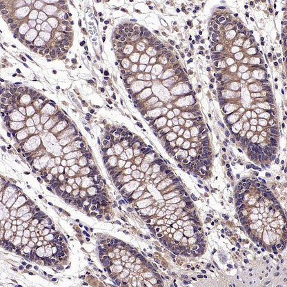 CK1α Recombinant Rabbit mAb ,PBS Only(SDT-2884-60)