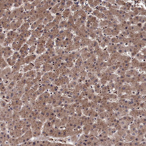 5HT1A Receptor Rabbit Polyclonal Antibody