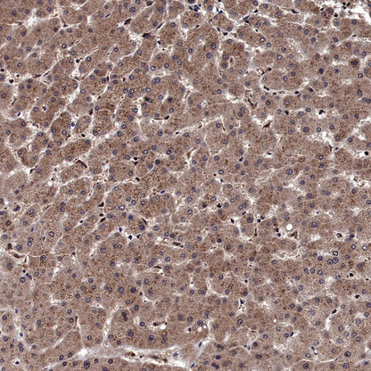 5HT1A Receptor Rabbit Polyclonal Antibody