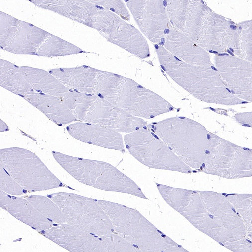 alpha smooth muscle Actin (acetyl E3) + ACTG2 (acetyl E3) Recombiant Rabbit mAb (S-3355)