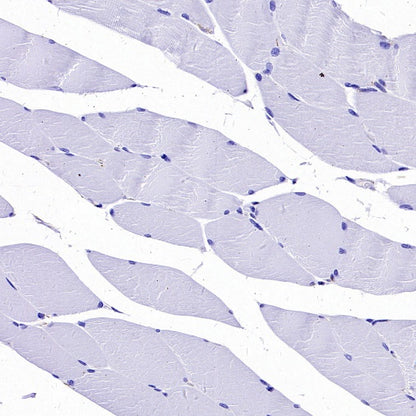 alpha smooth muscle Actin (acetyl E3) + ACTG2 (acetyl E3) Recombiant Rabbit mAb (S-3355)