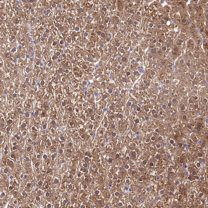 GCLM Recombinant Rabbit mAb (S-2209-19)