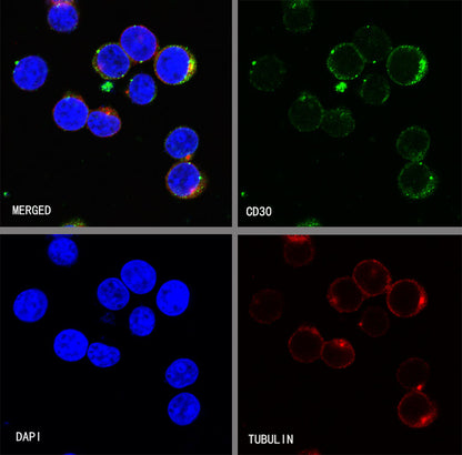 CD30 Recombinant Rabbit mAb (SDT-216-2)