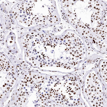 Histone H4 (acetyl K5) Recombinant Rabbit mAb (S-1464-112)