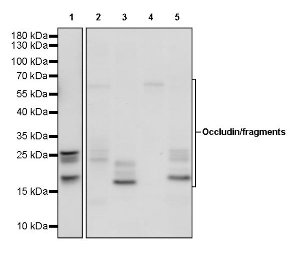 Occludin Recombinant Rabbit mAb (SDT-4588)