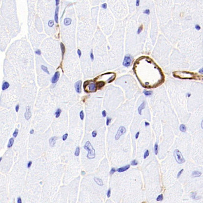 TAGLN/Transgelin Recombinant Rabbit mAb (S-1715-59)