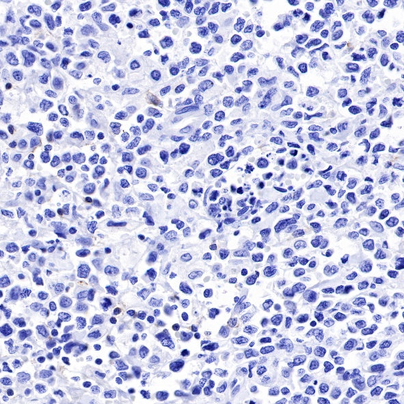 CD19 Recombinant Rabbit mAb (SDT-164-33)