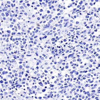 CD19 Recombinant Rabbit mAb (SDT-164-33)