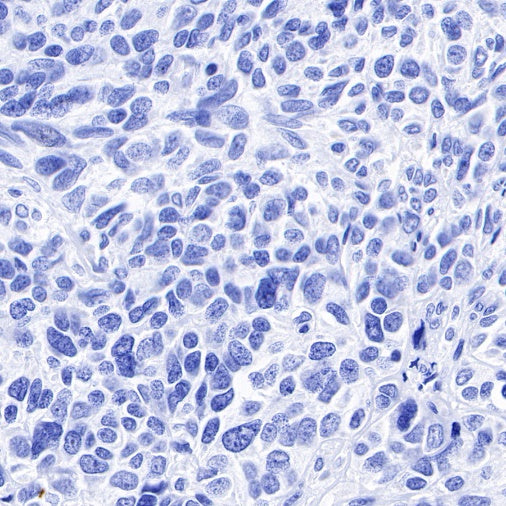 Inhibin alpha Recombinant Rabbit mAb (SDT-R307)