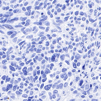 Inhibin alpha Recombinant Rabbit mAb (SDT-R307)