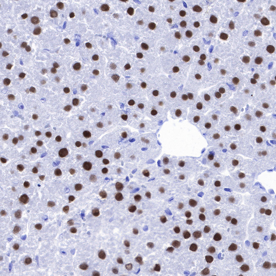 FOXA2 Recombinant Rabbit mAb (SDT-R174)
