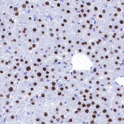 FOXA2 Recombinant Rabbit mAb (SDT-R174)