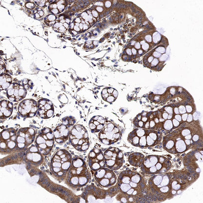 GSK3β Recombinant Rabbit mAb (S-1209-102)