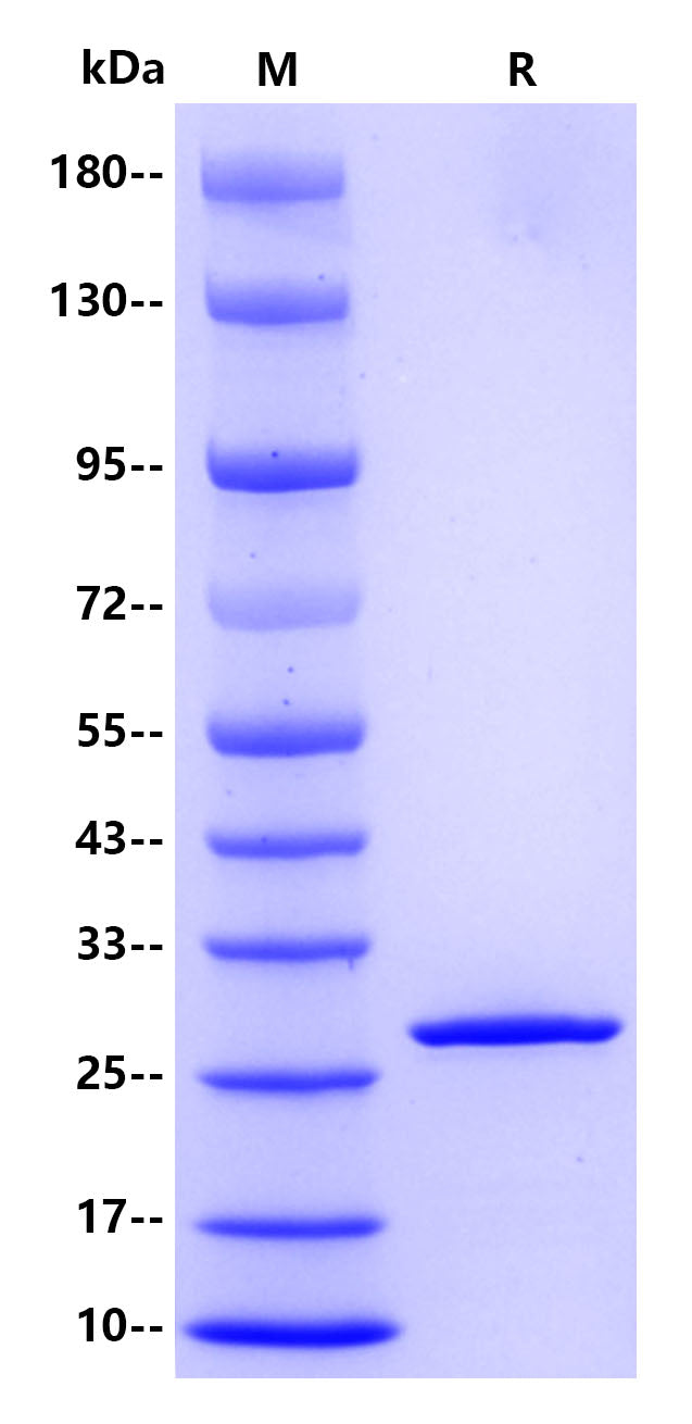 Human Galectin-3, His tag