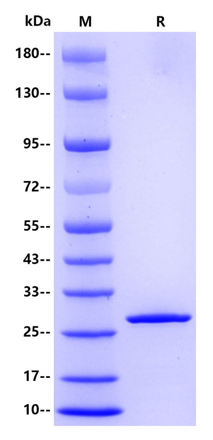 Human Galectin-3, His tag