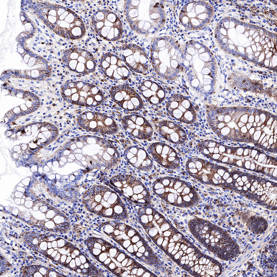 CD99 Recombinant Rabbit mAb (SDT-R122)