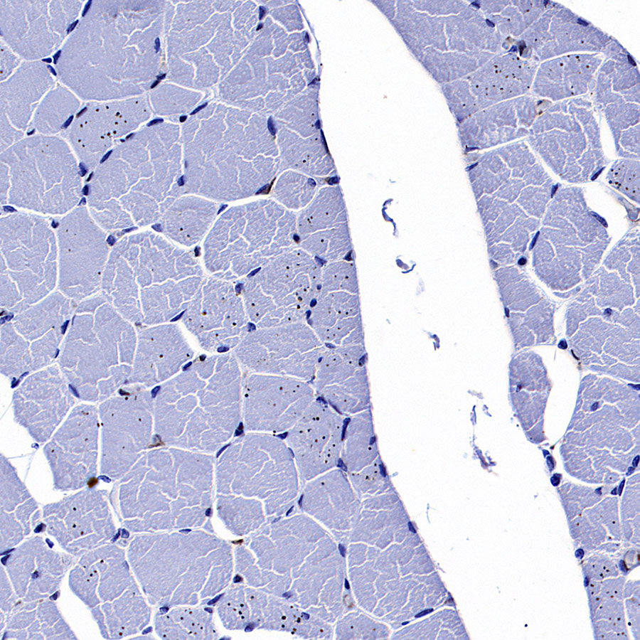 LPCAT2 Recombinant Rabbit mAb (S-4239-18)