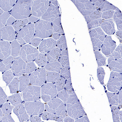 LPCAT2 Recombinant Rabbit mAb (S-4239-18)