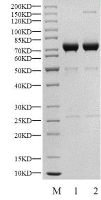 CSNK1G2(CK1γ2) GST Tag Protein, Human