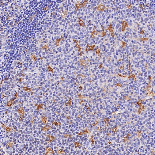 UBASH3B/Sts1 Recombinant Rabbit mAb (S-1307-5)