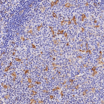 UBASH3B/Sts1 Recombinant Rabbit mAb (S-1307-5)