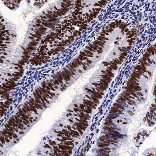 TAF15 Recombinant Rabbit mAb (S-1508-53)