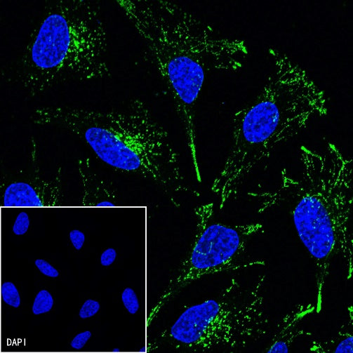 LAMP1 Recombinant Rabbit mAb (FITC Conjugate) (SDT-405-39)