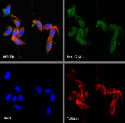 Rac1/2/3 Recombinant Rabbit mAb (S-2720-10)