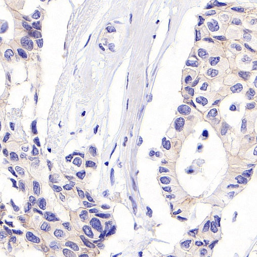 ErbB3 Recombinant Rabbit mAb (SDT-991-14)