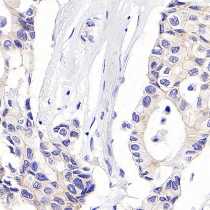 ErbB3 Recombinant Rabbit mAb (SDT-991-14)