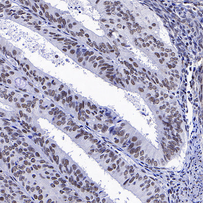 Caspase-8 Recombinant Rabbit mAb (S-2676-121)
