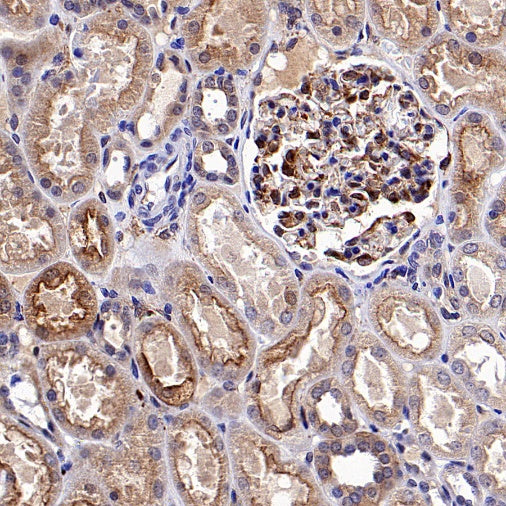 DAB2 Recombinant Rabbit mAb (S-2131-55)
