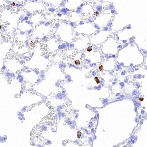 Cathepsin D Recombinant Rabbit mAb (S-R345)