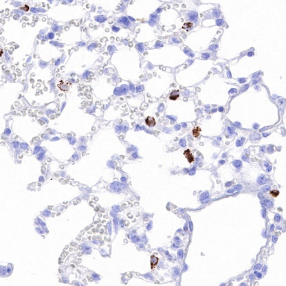 Cathepsin D Recombinant Rabbit mAb (S-R345)