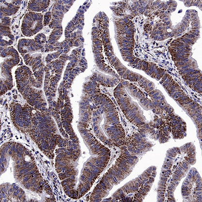 SDHA Recombinant Rabbit mAb (S-1458-43)