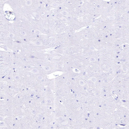 DAZL Recombinant Rabbit mAb (S-1552-6)