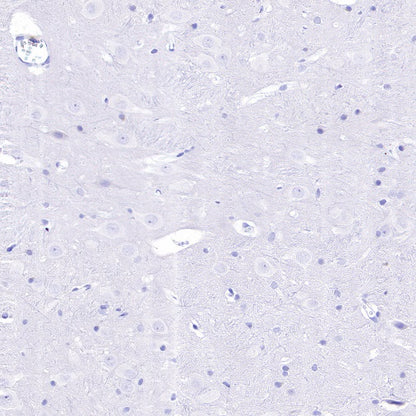 DAZL Recombinant Rabbit mAb (S-1552-6)