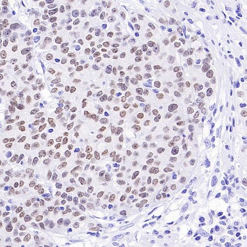 FOXA1 Recombinant Rabbit mAb, PBS Only  (SDT-2779-17)