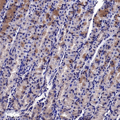 GSDMD Recombinant Rabbit mAb (S-3267)