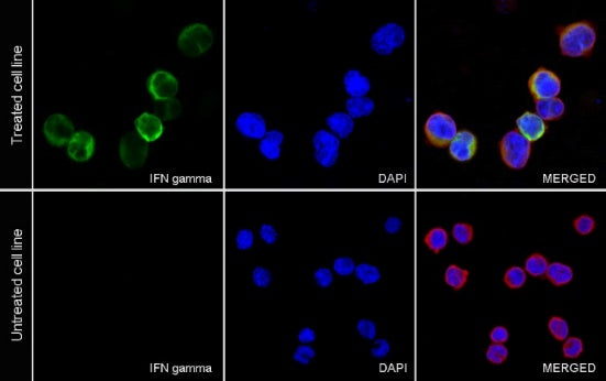 IFN-γ Recombinant Rabbit mAb (S-212-145)