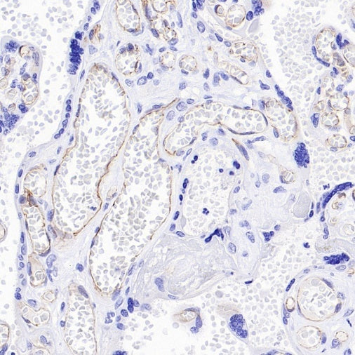 VE Cadherin Recombinant Rabbit mAb (S-3312-118)