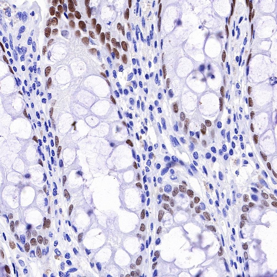 HNF4α Recombinant Rabbit mAb (SDT-373-64)