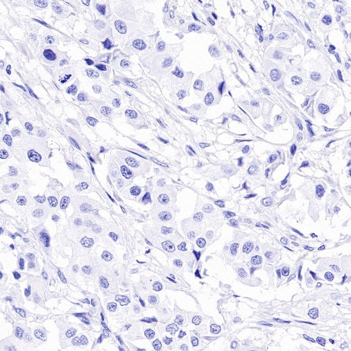 Reg4 Recombinant Rabbit mAb (SDT-1232-23)