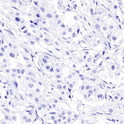 Reg4 Recombinant Rabbit mAb (SDT-1232-23)