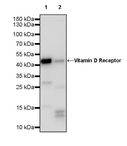 Vitamin D Receptor Recombinant Rabbit mAb (S-1719-7)