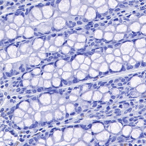 Carbonic Anhydrase 9 Recombinant Rabbit mAb (SDT-733-28)