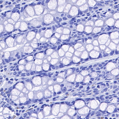 Carbonic Anhydrase 9 Recombinant Rabbit mAb (SDT-733-28)