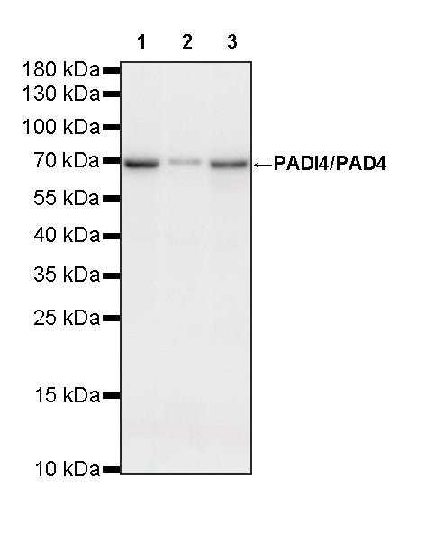 PADI4/PAD4 Recombinant Rabbit mAb (S-4347-19)