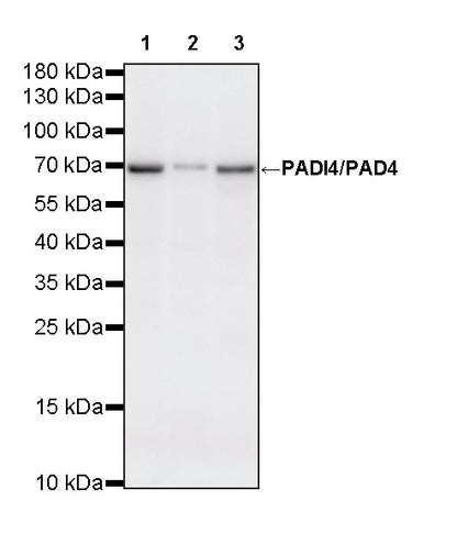 PADI4/PAD4 Recombinant Rabbit mAb (S-4347-19)